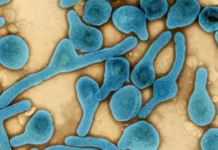 Virus de Marburgo: qué es, cómo se trasmite y cómo prevenir la enfermedad infecciosa detectada otra vez en África