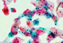 La historia de amor detrás del Papanicolaou, el test que ha salvado millones de vidas de mujeres