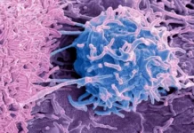 Cáncer: el misterio de los microbios que viven dentro de los tumores
