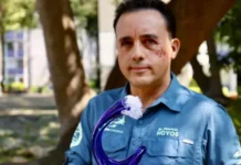 «Me perdonó la vida»: el impresionante relato del mexicano que sobrevivió a la mordida de un tiburón en la cabeza