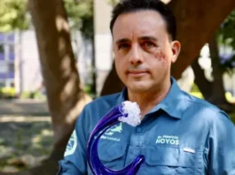 «Me perdonó la vida»: el impresionante relato del mexicano que sobrevivió a la mordida de un tiburón en la cabeza