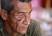 «Nunca pensé que me iban a atacar a mí»: hablan los sobrevivientes del ataque con misil al Bloque 12, el edificio donde murió una mujer durante el bombardeo de EE.UU. en Venezuela