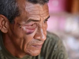 «Nunca pensé que me iban a atacar a mí»: hablan los sobrevivientes del ataque con misil al Bloque 12, el edificio donde murió una mujer durante el bombardeo de EE.UU. en Venezuela