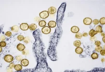 Qué es el hantavirus y cuáles son los síntomas del virus sospechoso de causar 3 muertes en un crucero que se dirige a España