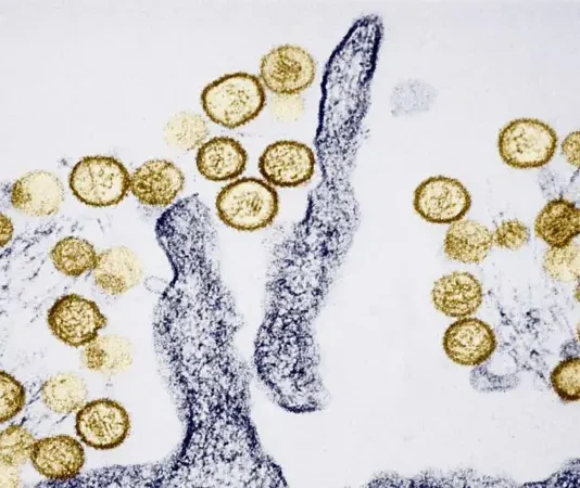 Qué es el hantavirus y cuáles son los síntomas del virus sospechoso de causar 3 muertes en un crucero que se dirige a España