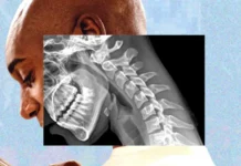 «Cuerpo de teléfono»: cómo la tecnología nos arruga el cuello y debilita las manos
