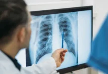 Qué es un adenocarcinoma pulmonar, el tipo de tumor maligno que le extirparon al papa León XIV